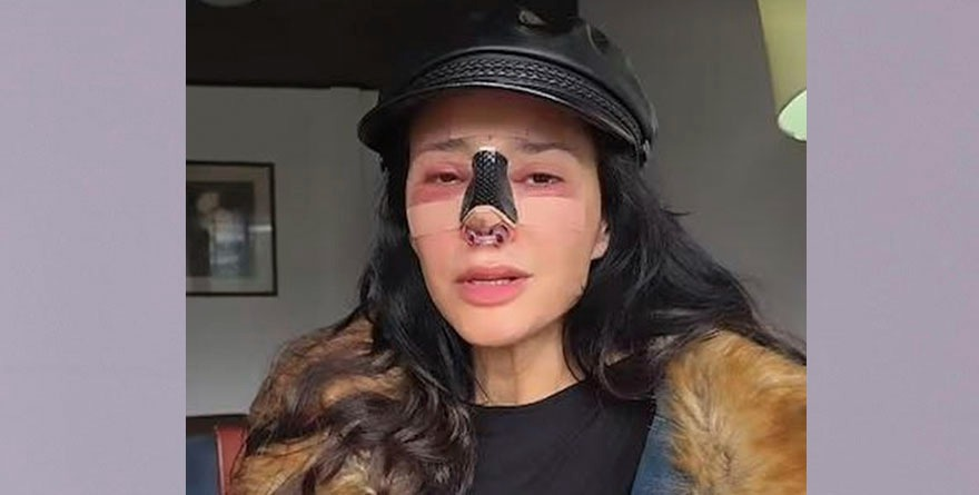 DORISMAR UNA CIRUGÍA QUE LA DAÑÓ