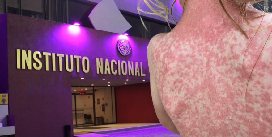 ACTIVA INE HOME OFFICE TRAS CASO DE SARAMPIÓN