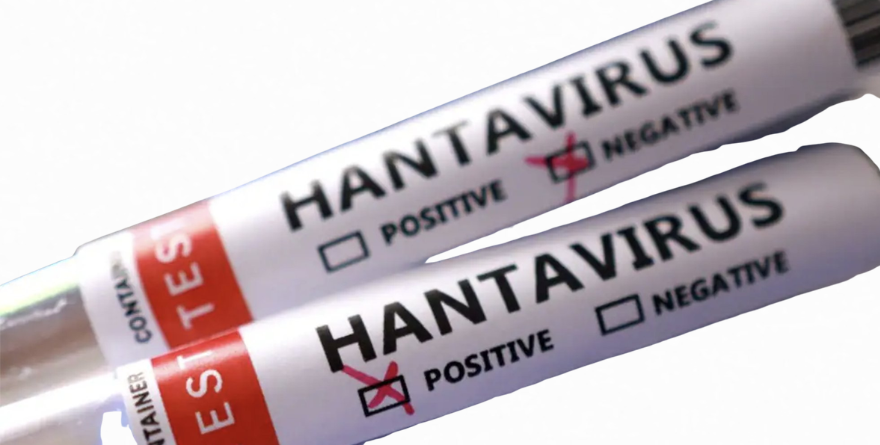 DAN 4 PERSONAS EN ITALIA NEGATIVO POR HANTAVIRUS