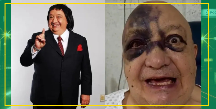 LUIS DE ALBA CON ROSTRO DESFIGURADO: EL PIRRURIS REVELA TODA LA VERDAD