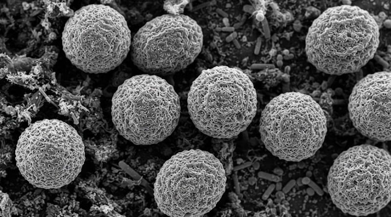 LECHUGA CON CYCLOSPORA: FDA SE RETRACTA MIENTRAS INVESTIGACIÓN PROSIGUE