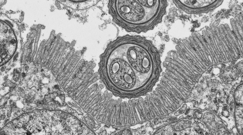 ¿CÓMO SURGE Y SE PROPAGA LA CICLOSPORIASIS ENTRE LAS PERSONAS?