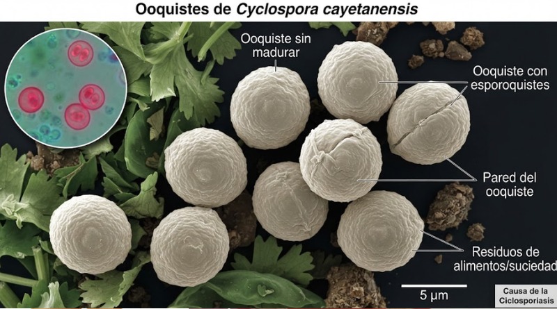 EN EU EXPONEN FALLAS DE RASTREO DE ALIMENTOS POR CICLOSPORIASIS